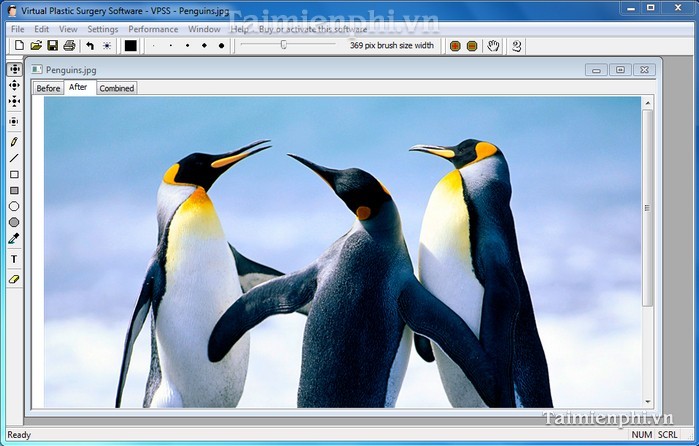 Virtual Plastic Surgery Software